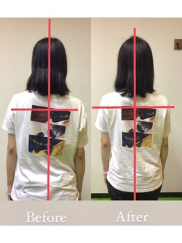 リトラ(Retra)/整体・BeforeAfter