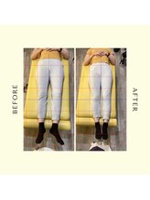 多摩 唐木田整体室/産後骨盤のビフォーアフター