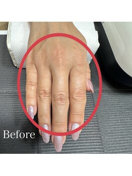 スペシャルハンドパック