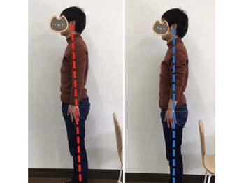 りょうたろう整体院/30代男性姿勢改善