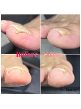 ララビューティ(lala beauty)/爪切り