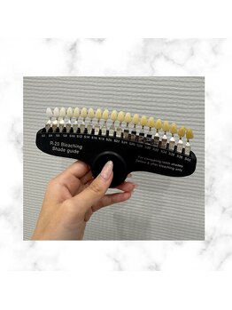 ホワイト 上乃木南店(WHITE)/歯のトーンチェック