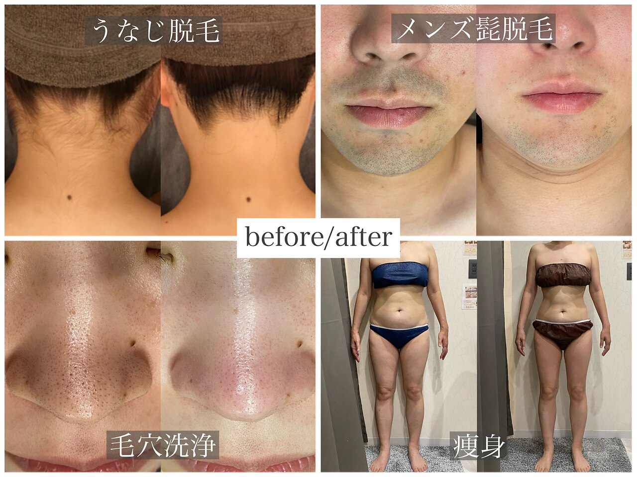 アネラ(anela)｜ホットペッパービューティー