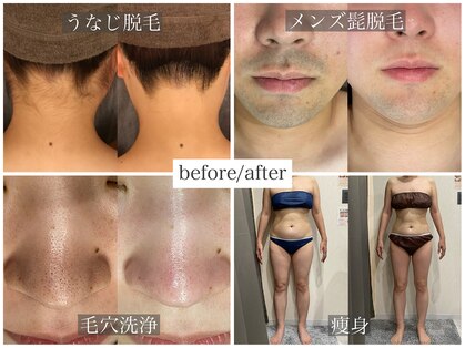 アネラ(anela)の写真