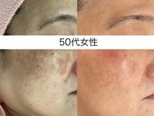 サクラ 本厚木駅前店(SAKURA)/本厚木シミケア/伊勢店シミケア