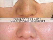 ベルエドゥース(Belle et Douce)の雰囲気（背中の毛穴も綺麗に変化！！）