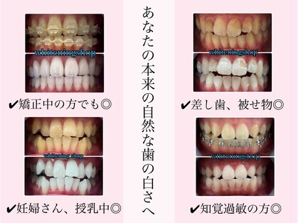 ホワイトニングショップ 豊橋店の写真