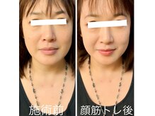 ヴィエンナ VIENNAの雰囲気（【小顔】１回の施術でこの効果！！目も縦にパッチリ開きます！）