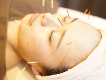 本八幡鍼灸院/40代からの美容ケア【美容鍼】