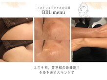 美容サロンで話題のBBL！あらゆる肌悩みに対応します♪