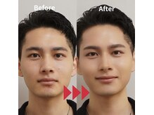 メンズメイク コレクション 名古屋店/Before After