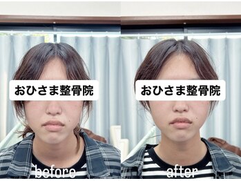 おひさま整骨院 整体院 姫路店/B＆A【姫路/小顔矯正/整体】