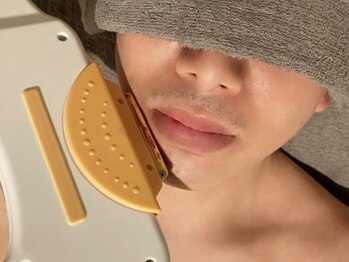 バタフライ 津田沼店(Butterfly)/美顔ヒゲ脱毛