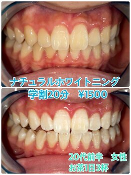 プラチナムビューティー 川口駅前店(PLATINUM BEAUTY)/初回から6トーンアップ♪