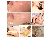 プレジール エテ(plaisir Ete)