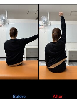 大久保ひまわり整骨院の写真/当店1番人気！【骨盤・姿勢矯正】今までにない体の軽さを体験ください☆身体の歪みを根本改善！