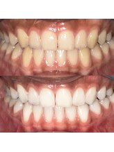 ライトビューティー 池袋店(LightBeauty)/症例写真