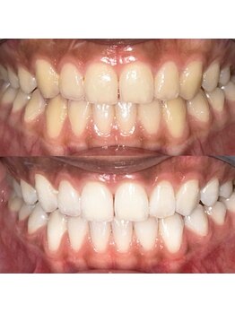 ライトビューティー 池袋店(LightBeauty)/症例写真