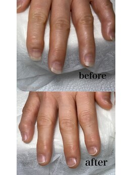 ペル(Per)/ハンドケアのbefore ＆ after