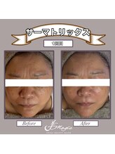 ビーマジック(美magic)/