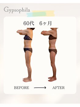 ジプソフィラ(Gypsophila)/痩身ビフォーアフター