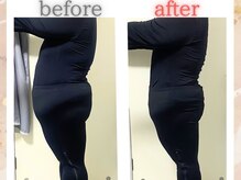 ヨサパーク リリー(YOSA PARK Lily)/