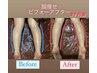 【内出限定カッピングで脚のむくみ取り痩身】通常6000円→お試し3500円