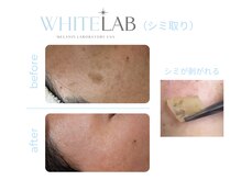 テセラ(TESELA)の雰囲気（【ホワイトラボ正規店/最新シミケア】植物由来100％成分を使用♪）