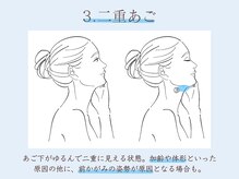 シーズ ラボ 町田店/二重あご