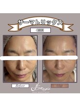 ビーマジック(美magic)/