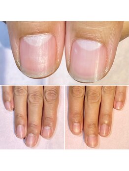 ココデネイル(cocode nail)/悩み:乾燥(40代前半)