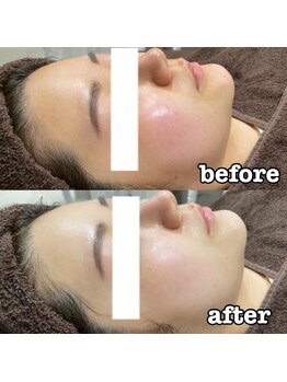 ディアー 原宿(Diar)/クリスティーナ　アンストレス