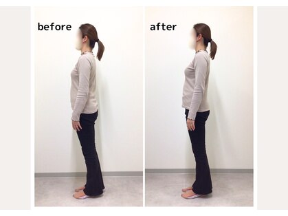 ユルメール 整体院(ulmer)の写真