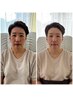 40,50代モニター募集中!限定5名! 韓国肌管理☆白玉×小顔ウルドム初回体験