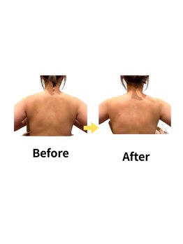 ムーロ(muro.)/Before After