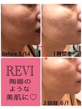 ホワイトセージ(White Sage)/ビフォーアフター2