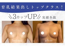 ビテュセスリー はなみずき店(美tusais3)