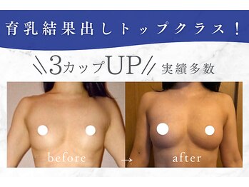 ビテュセスリー はなみずき店(美tusais3)