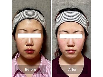 キュープ 鹿児島伊集院店(Qpu)/