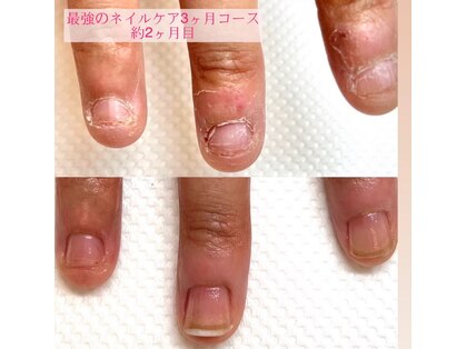 チアロ(Chiaro)の写真
