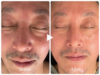 ルース(LUZ)/一目で分かる潤い肌/メンズ小顔