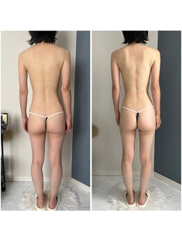 モア(moa)/ヒップアップ/お尻/下垂/茅ヶ崎