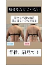 ユノン(yunon)/ビフォーアフター