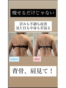 ユノン(yunon)/ビフォーアフター