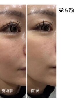 メディカルエース(MedicalAce)/前顔フォト