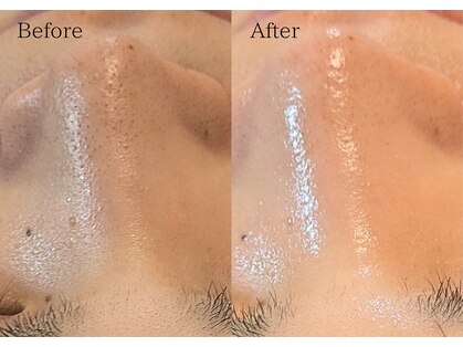 ラレーヌ(La Reine)の写真