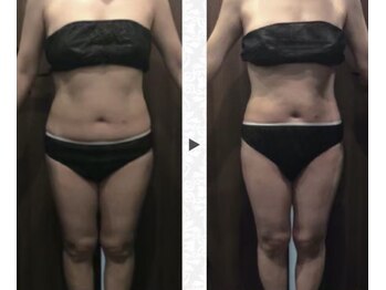 ニュイブラーシュ(nuit blanche)/女性の永遠のテーマ/痩せたい！