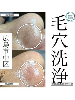 ジェンヌ(jenne.)/リピート9割超え人気メニュー！