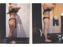 パーフェクトボディプレミアム 札幌駅前店(PERFECT BODY PREMIUM)/お客様　ビフォーアフター（31）