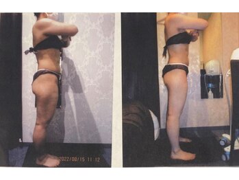 パーフェクトボディプレミアム 札幌駅前店(PERFECT BODY PREMIUM)/お客様　ビフォーアフター（31）